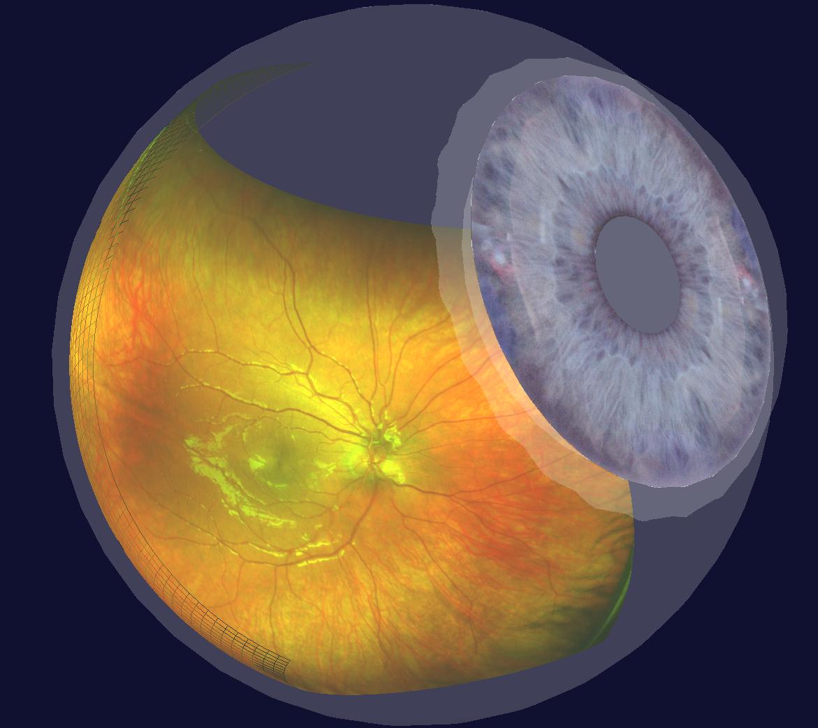 Digital Retinal Examination-2